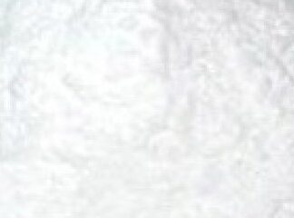 Precipitated Calcium Carbonate